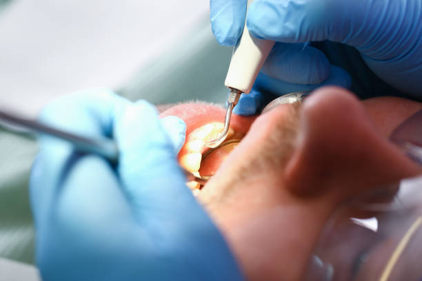 Best Emergency Denture Repair in St Francisville, LA