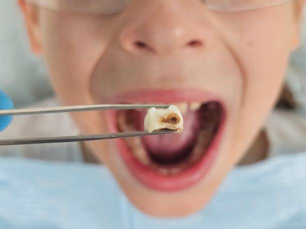 Best Emergency Orthodontic Repairs in St Francisville, LA