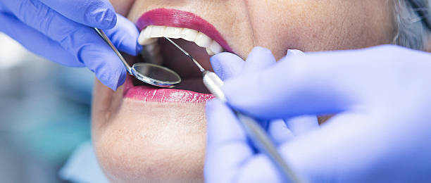 Best Emergency Cosmetic Dentistry (e.g., broken veneers) in St Francisville, LA